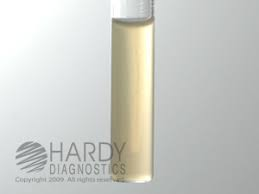 <p><strong>Identify the medium.</strong></p>
