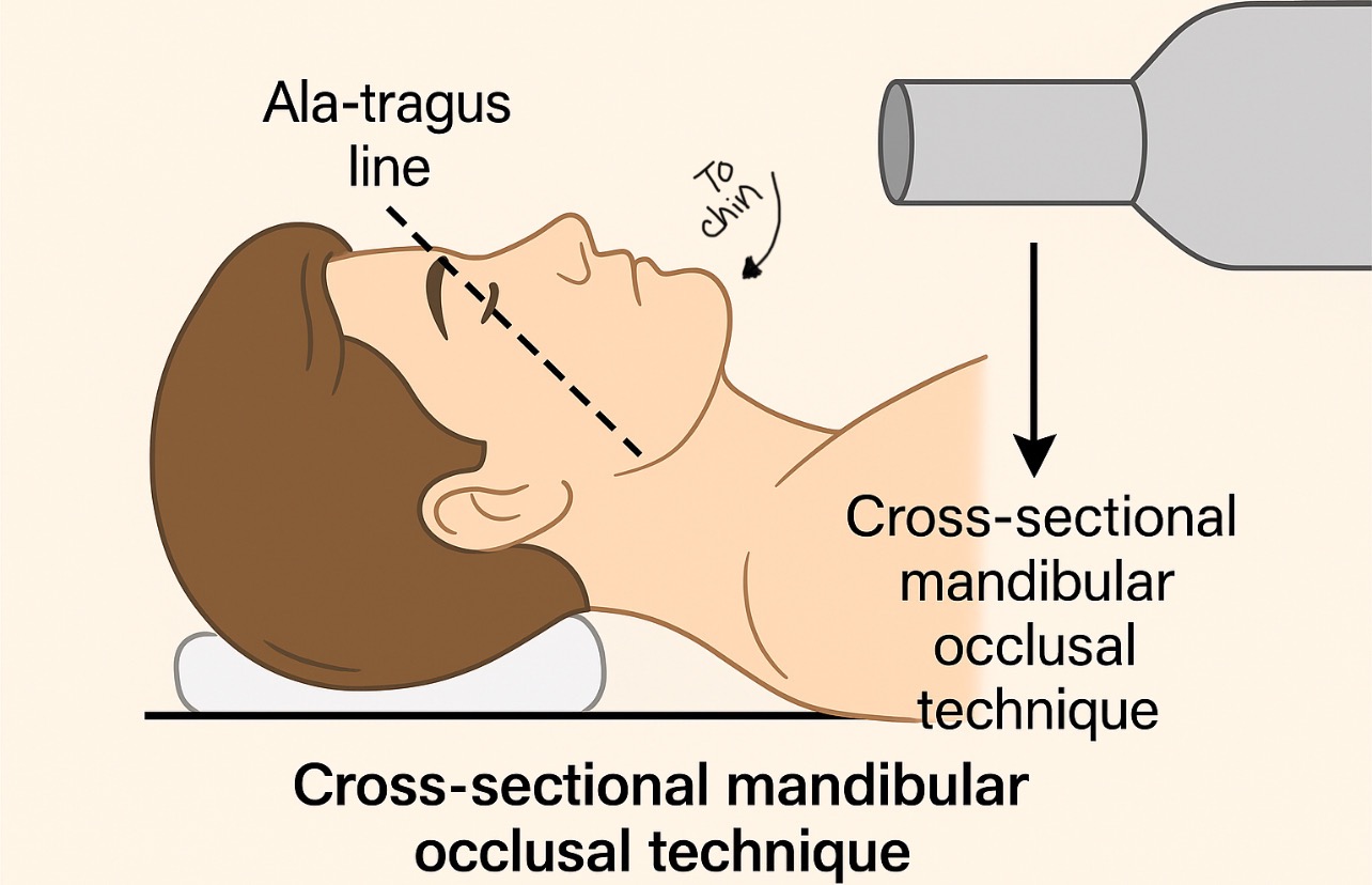 <p><span>How is the patient’s head positioned for the cross-sectional mandibular occlusal technique?</span></p>