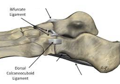 <p>calcaneocuboid ligament and bifurcated ligament</p>