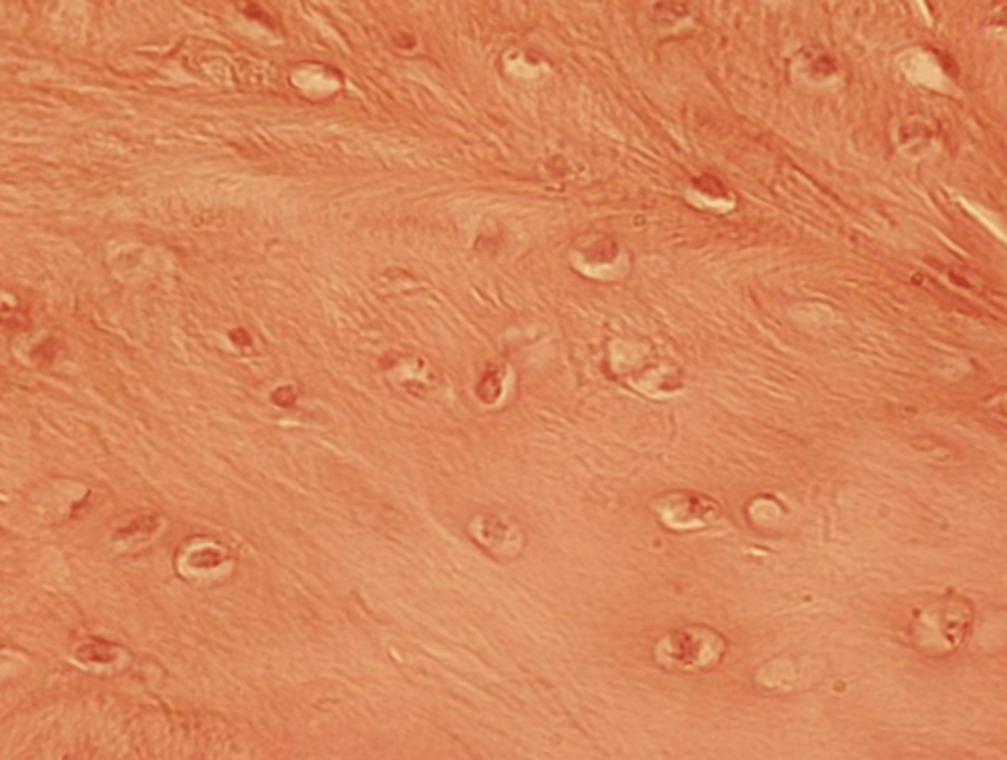 <p>Cell type: chondrocytes</p><p>Function: more collagen fibers for high tensile strength and shock absorption</p><p>Location: found in intervertebral disks and knee joint</p><p>Matrix: contains many parallel collagen fibers</p>