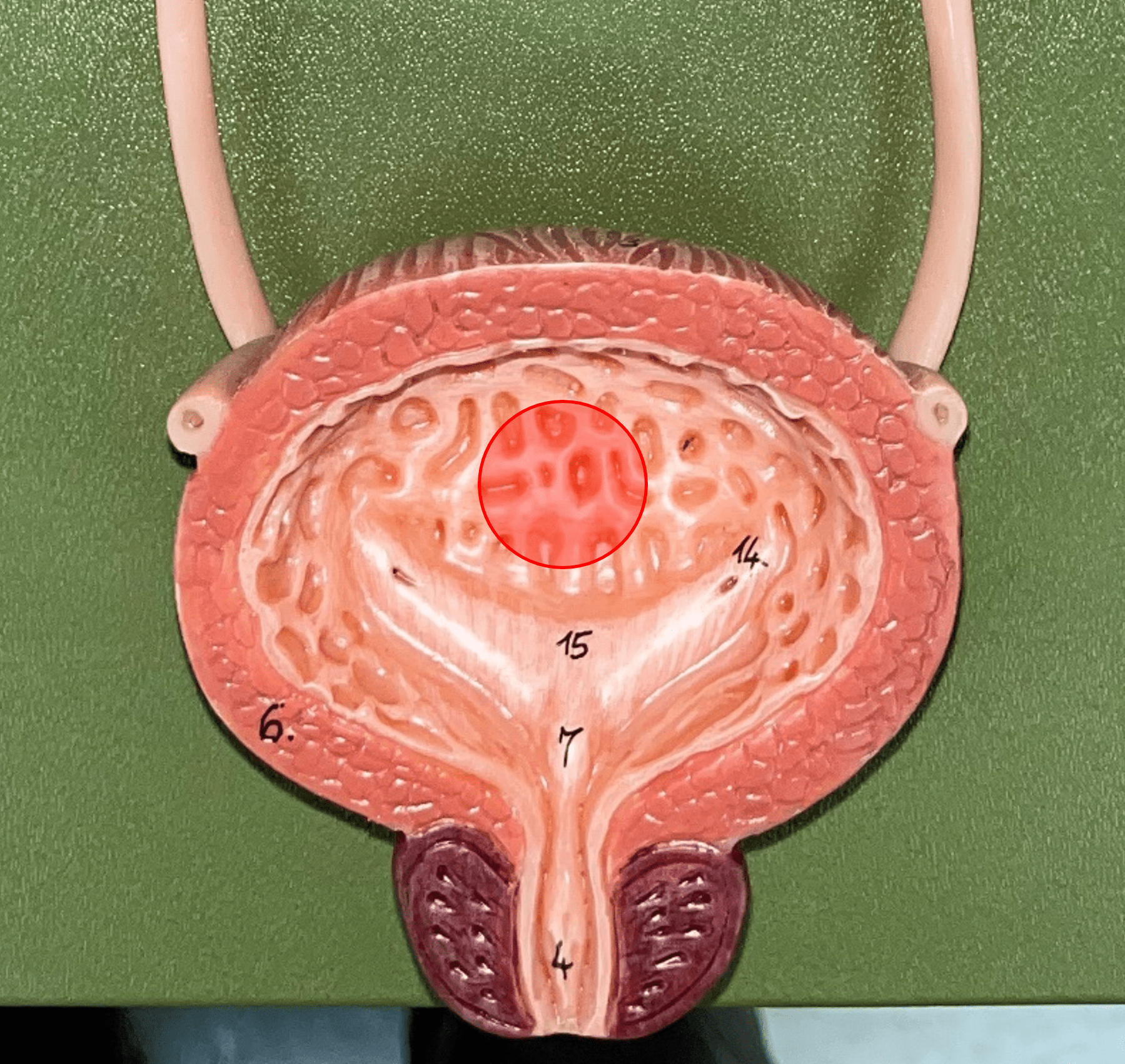 • Part of the urinary bladder.

• Folds of the mucous membrane of the bladder.

• Flattens as the bladder fills with urine to increase capacity.