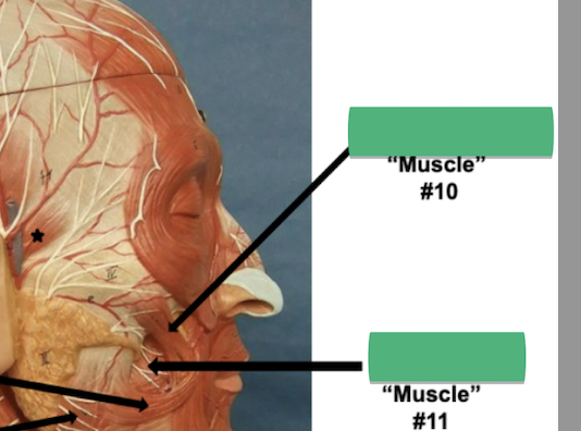 <p>Label muscle #10 </p>