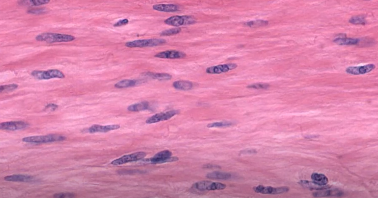 <p>Smooth Muscle</p>