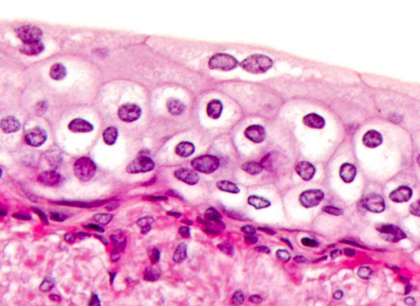 <p>is this transitional epithelium contracted or relaxed?</p>