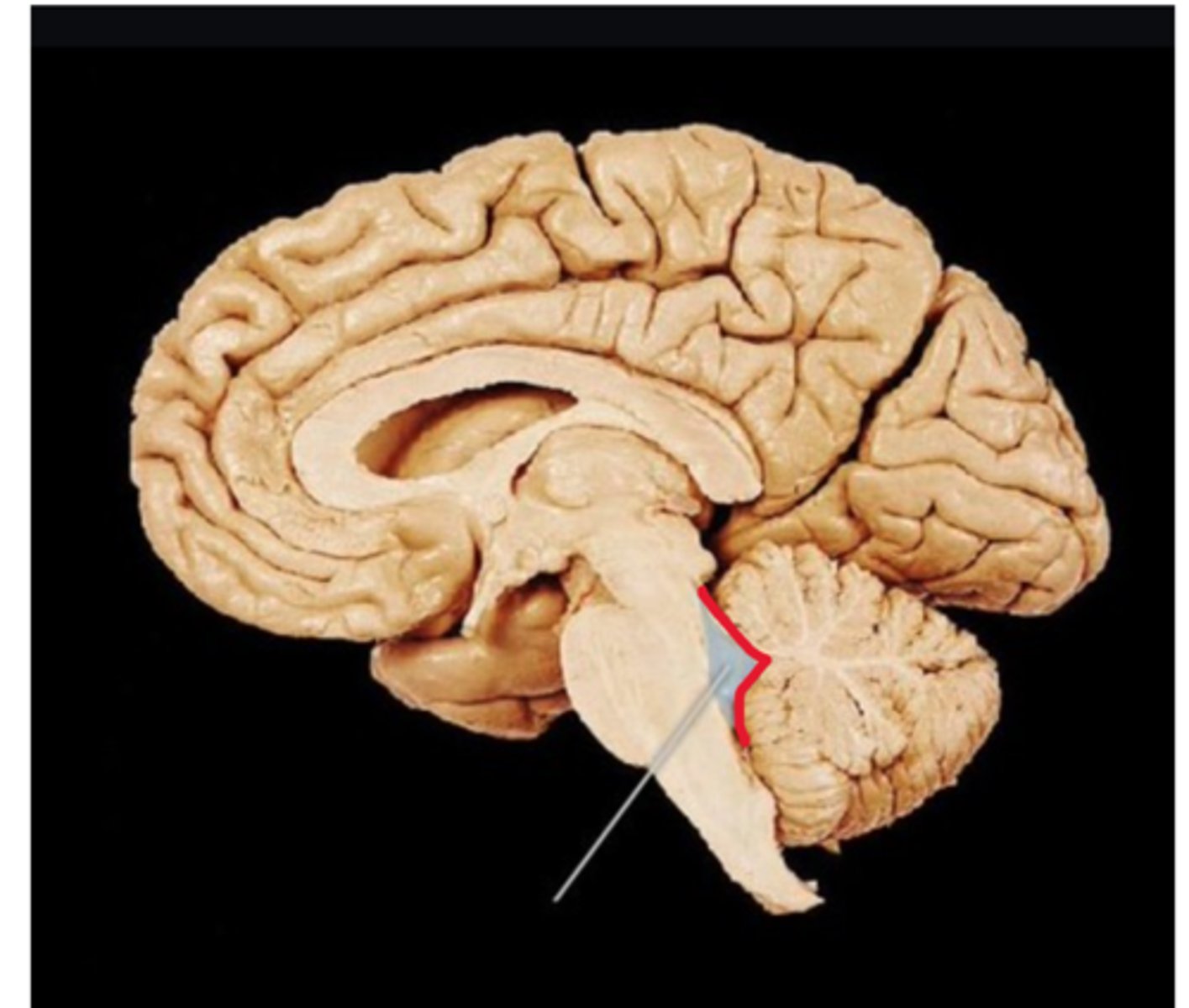 <p>Structure. Sides of triangle against cerebellum</p>
