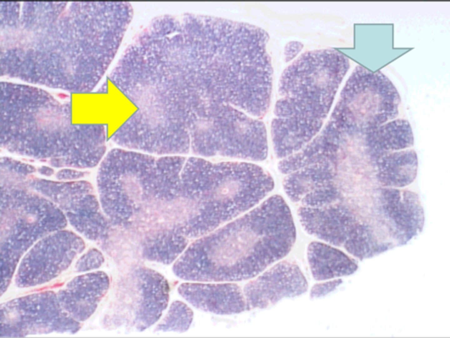 <p>where is this tissue? thymus</p>