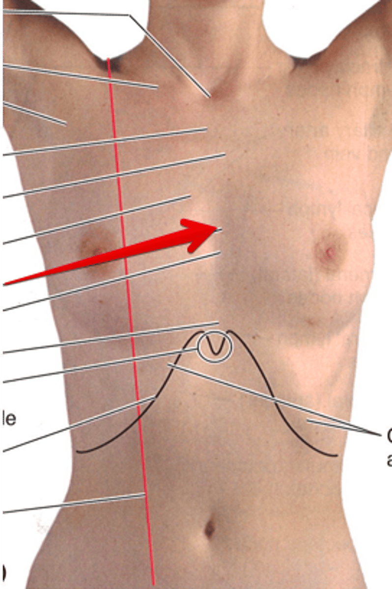 <p>Identify the red arrow.</p>