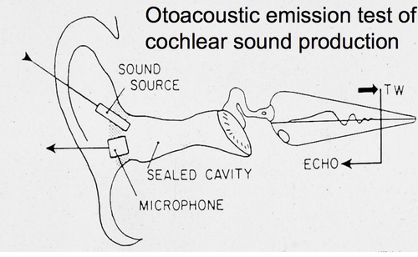 <p>Acoustic energy measured within the ear canal that is produced by the cochlea, specifically movement or motility of outer hair cells. Evoked OAEs, including transient (TEOAEs) and distortion product (DPOAE) otoacoustic emissions are generated by acoustic stimulation of the ear.</p>