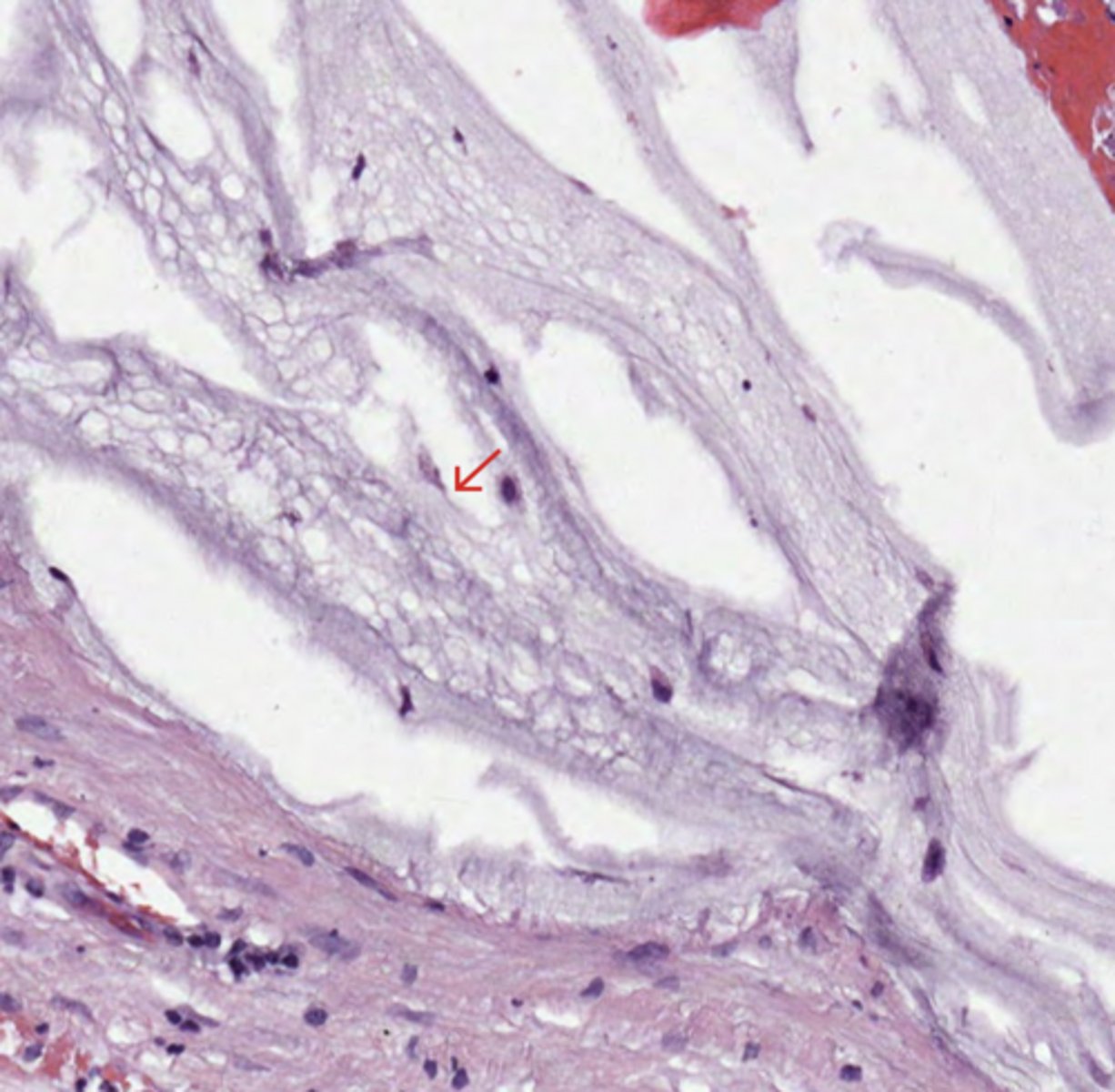 <p>Colon</p>