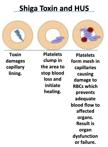 <p>important pathogen in north america. produces shiga toxin (same toxin produced by shigella dysenteriae). complication: development of hemolytic uremic syndrome (HUS), which results in death or chronic renal disease. transmitted by food, water, direct contact. implicated food products: ground beef, salami, raw milk, alfalfa sprouts, unpasteurized apple cider &amp; juice, contaminated pork, poultry, lamb, bagged fresh spinach</p>