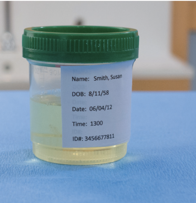 Urine 