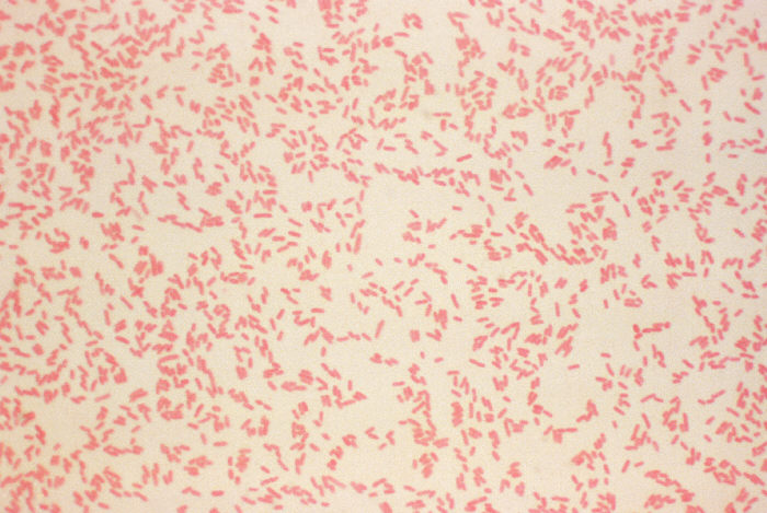 <p>pink thin </p><p></p><ul><li><p>wall is made of peptidoglycan </p></li></ul><p></p>