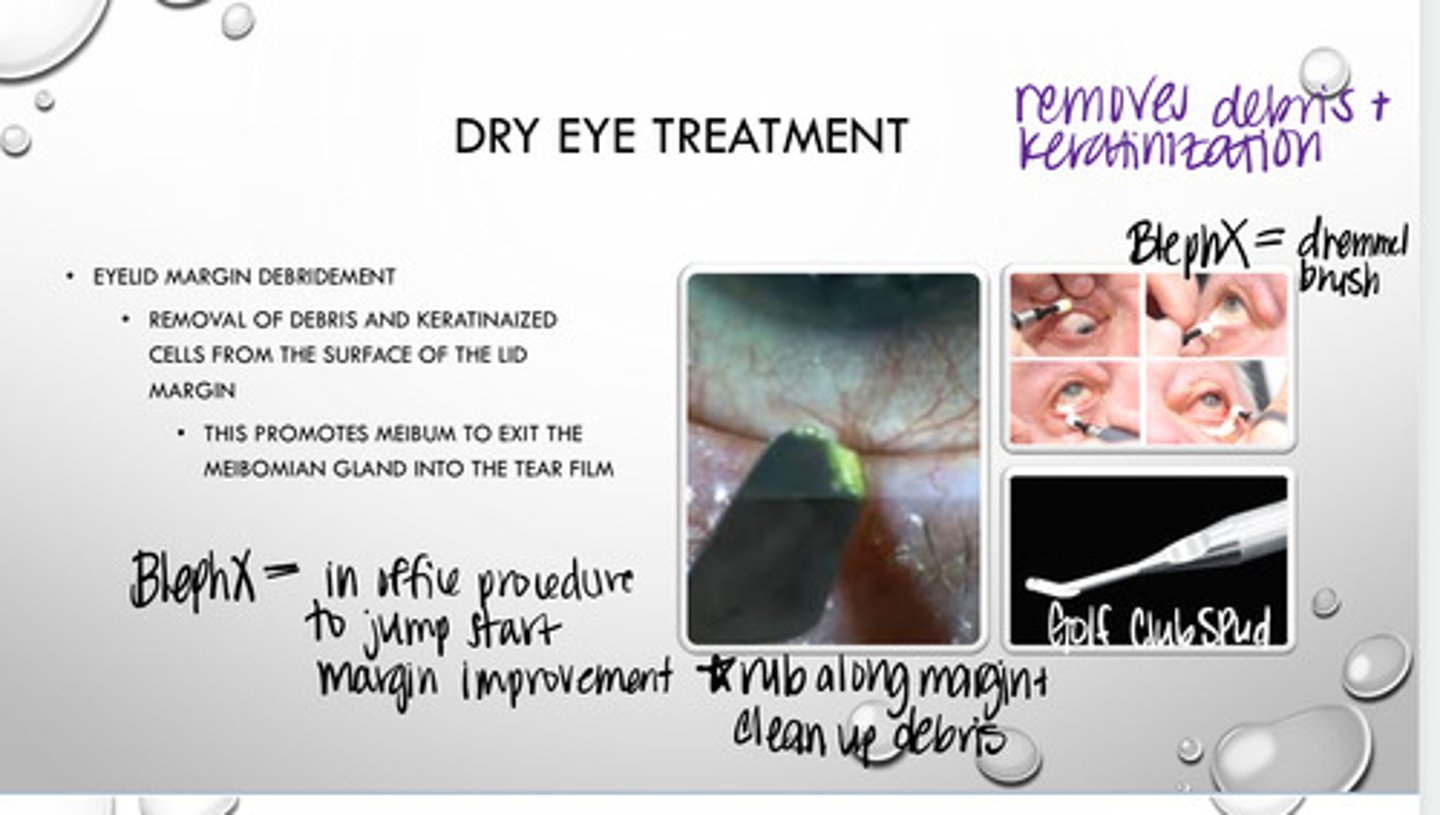 <p>What does lid margin debridement promote?</p>