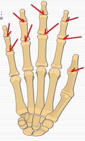 <p>-Are the joint spaces in-between phalanges digits</p><p>-(also the 1st digit only has an interphalangeal jt. and a metacarpohalangeal jt.)</p>