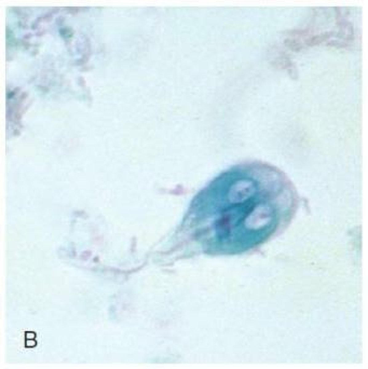 <p>The small intestine, cecum, and colon, specifically the duodenum.</p>