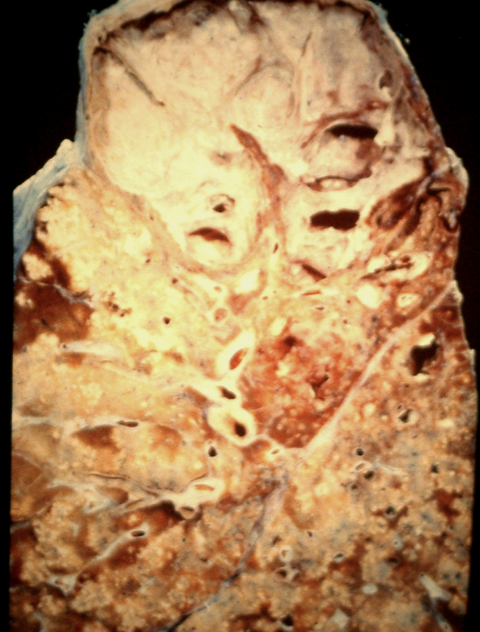 <p>الي يسار فوق هيش</p>