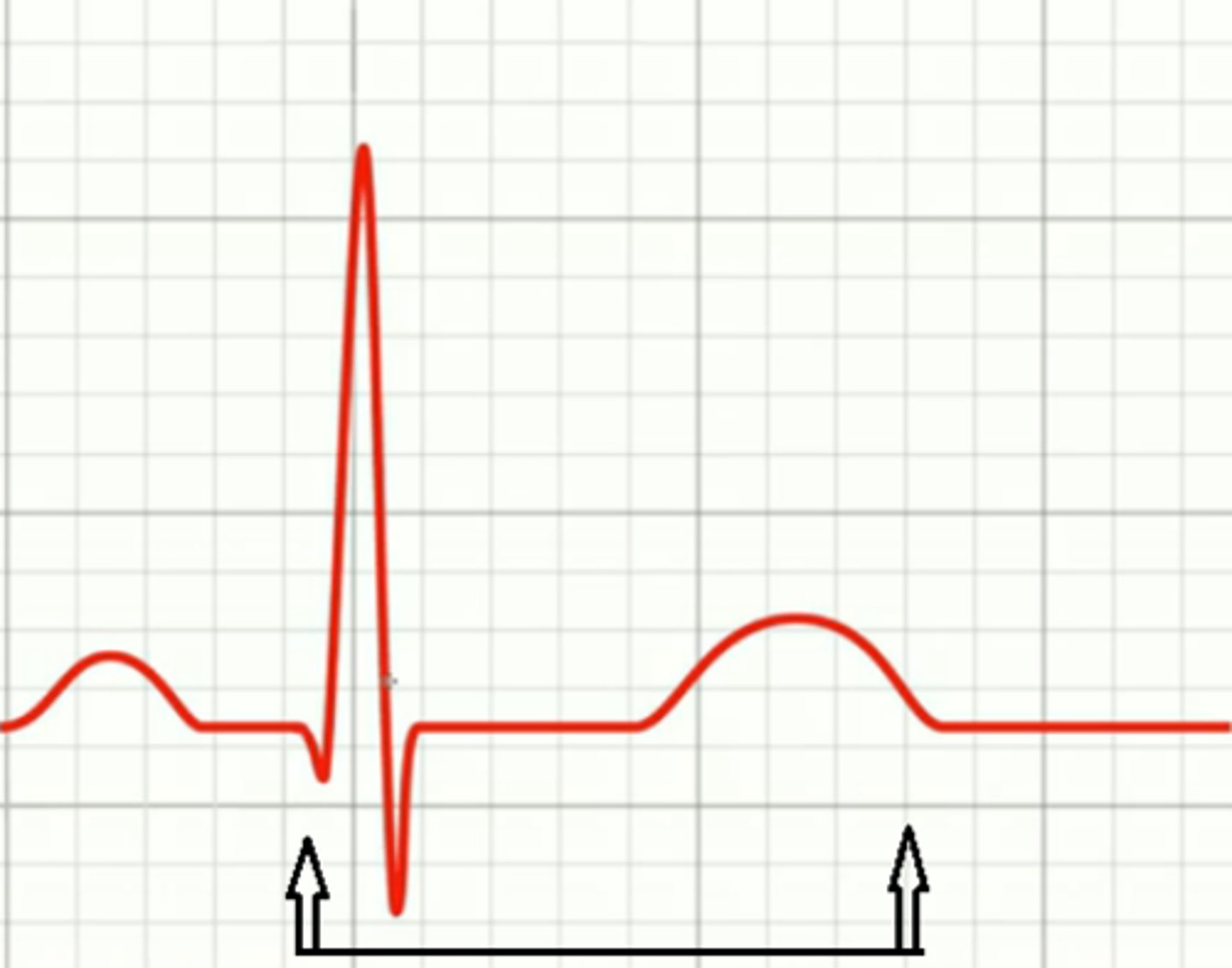 <p>Duration of ventricular systole (time it takes ventricles to depolarize &amp; repolarize); should be ~1/2 the R-R interval</p>