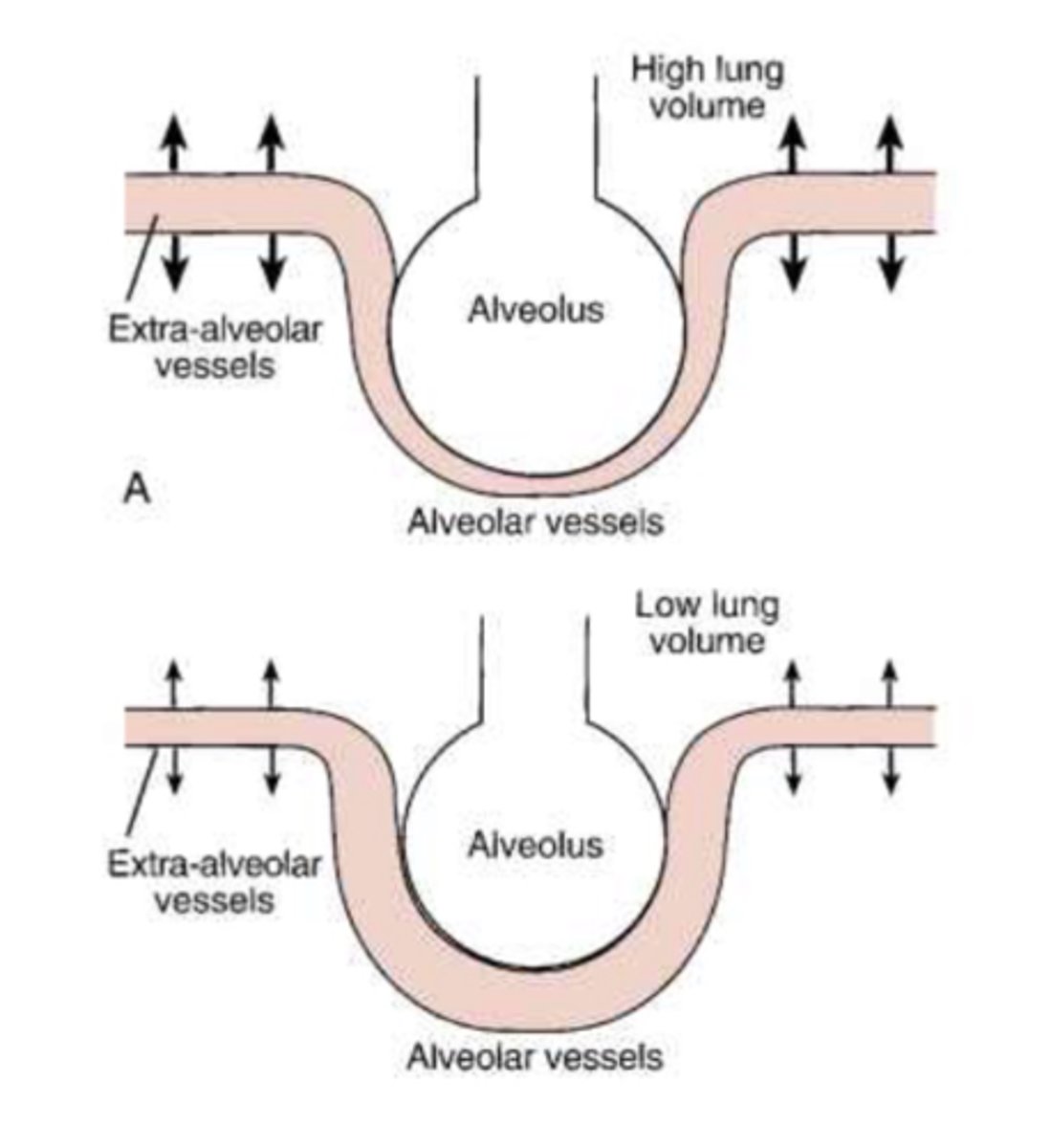 <p>when the lungs expand, the extra-alveolar vessels get pulled open by the expansion of the attached parenchymal tissue</p>
