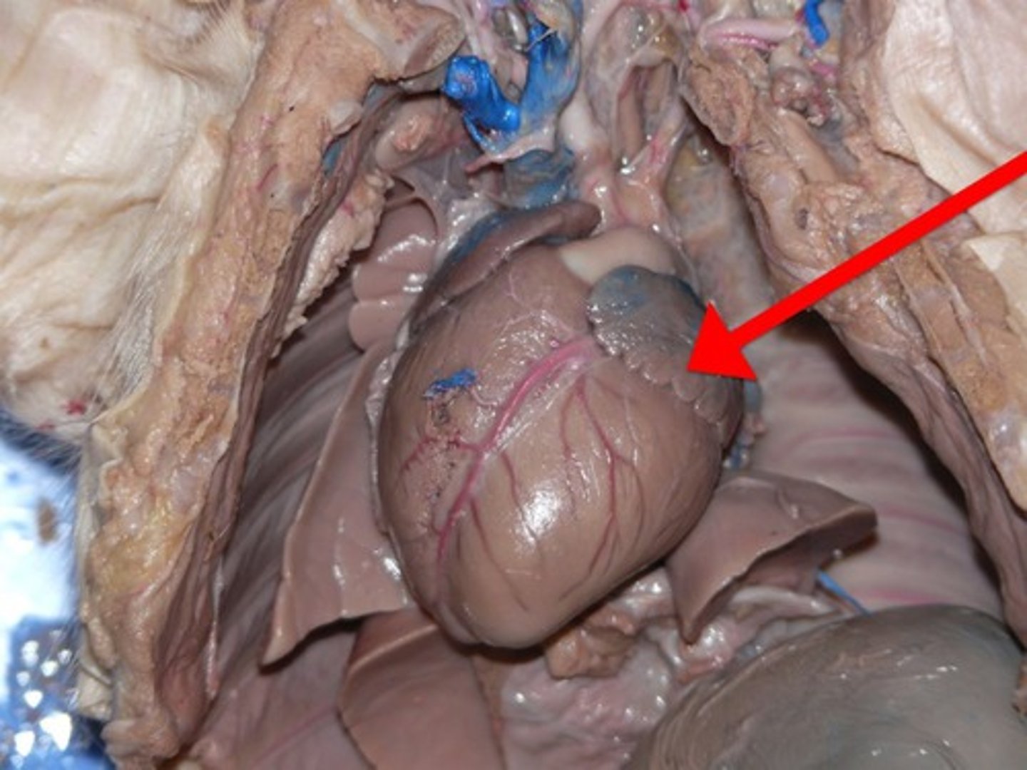 <p>Chamber that receives oxygenated blood from the pulmonary veins and pumps it into systemic circulation.</p>