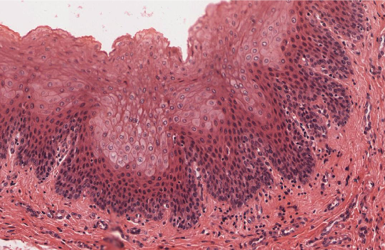 <p>oropharynx</p>
