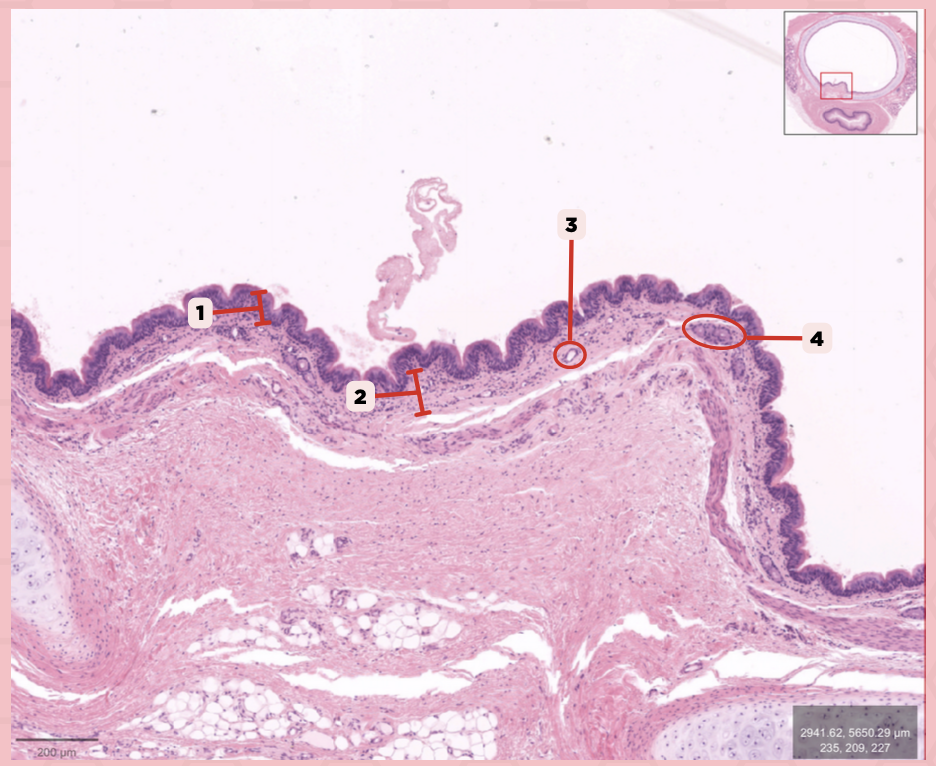 <p>Specify the type of glands are tracheal glands.</p>
