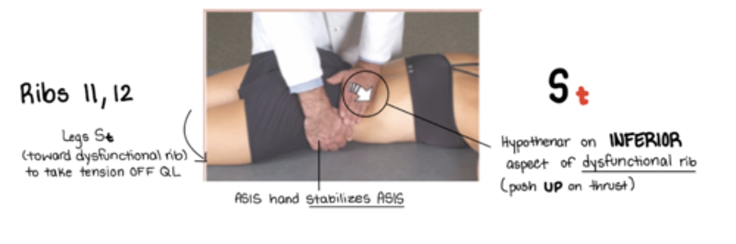 <p>St = legs away from me</p><p>standing OPPOSITE side of dysfunctional rib</p><p>hypothenar eminence on inferior aspect of dysfunctional rib - to push rib back UP</p><p>(other hand stabilizes on ASIS)</p><p>ribs stuck DOWN</p>
