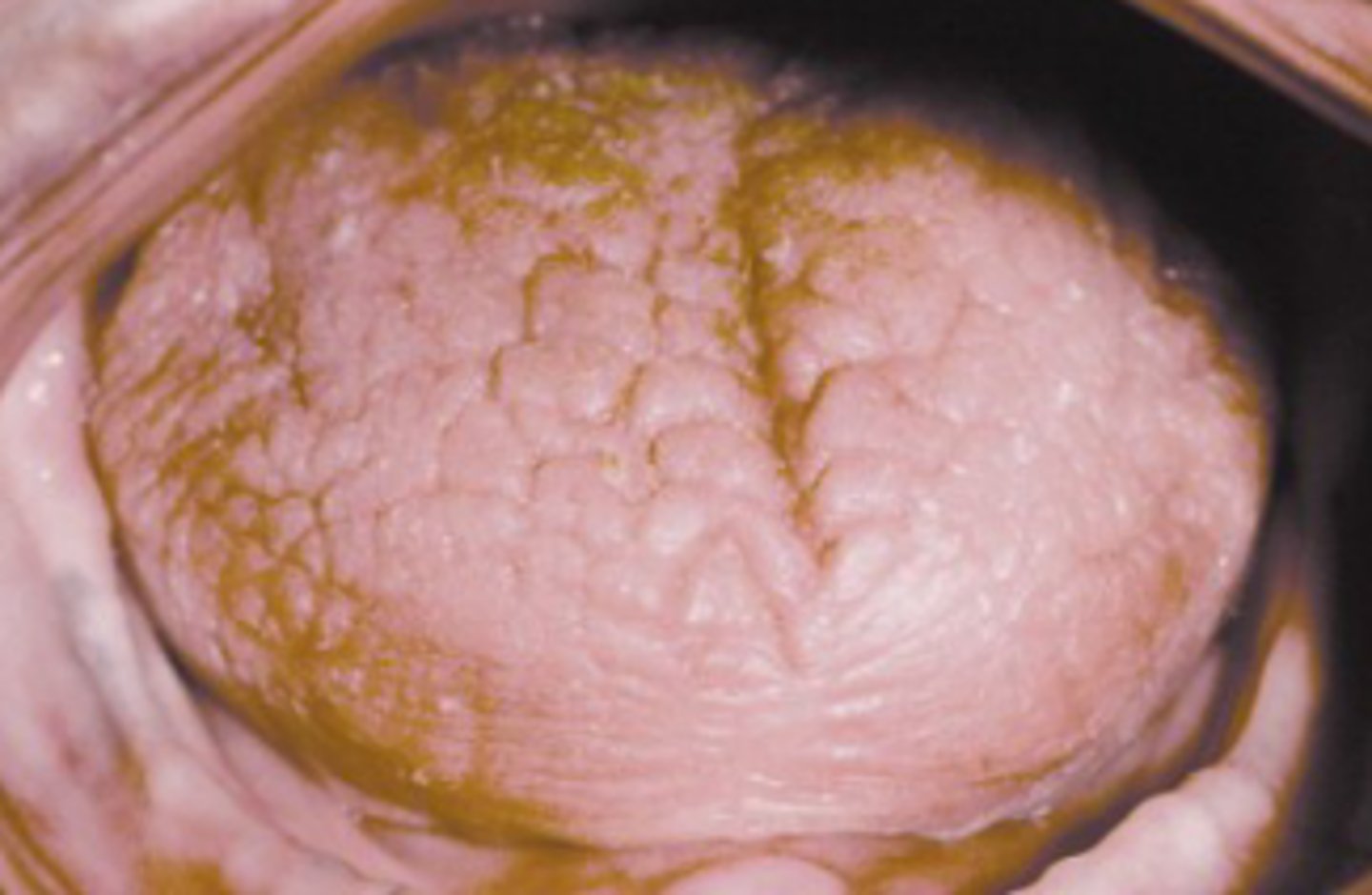 <p>Dry mouth + eyes</p>