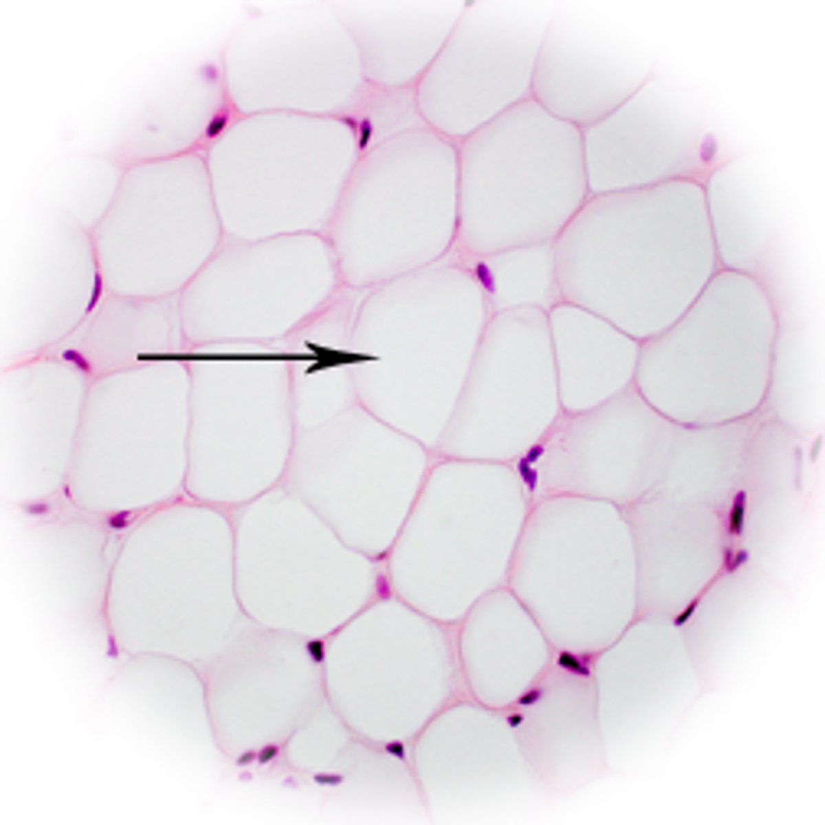 <p>Fat cells found in adipose CT</p>