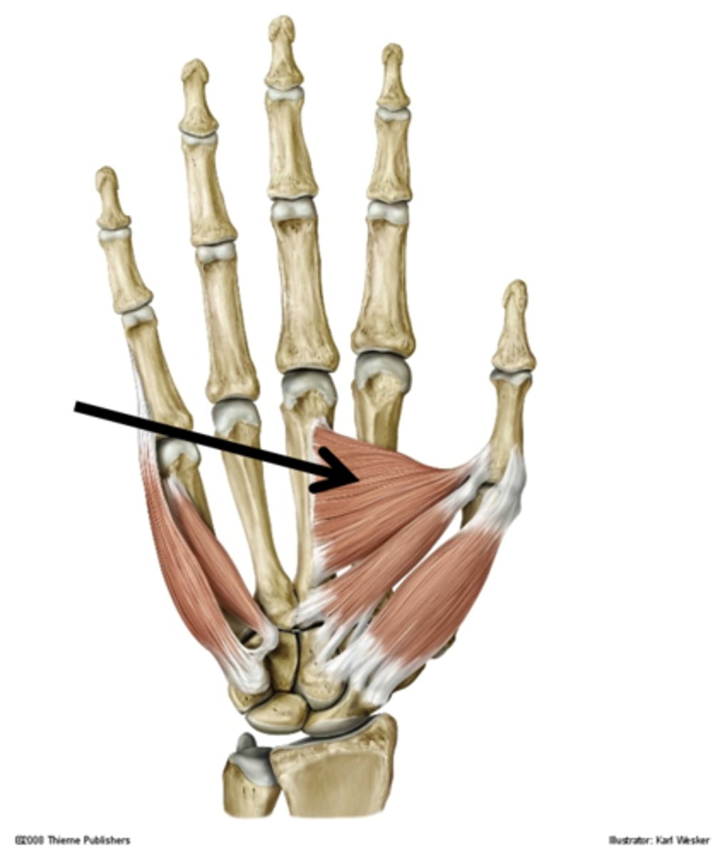 <p>proximal phalanx of thumb</p>