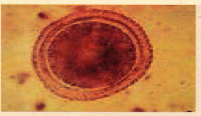 <p>Egg of?</p>