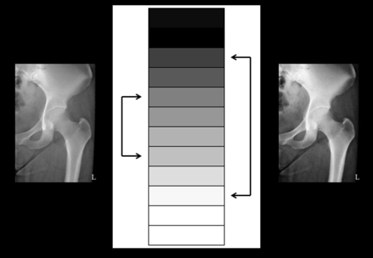 <p>adjusts contrast of the digital image</p>