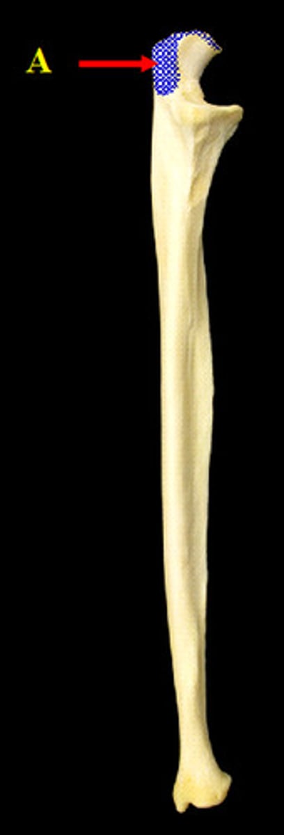<p>Name the structure.</p>