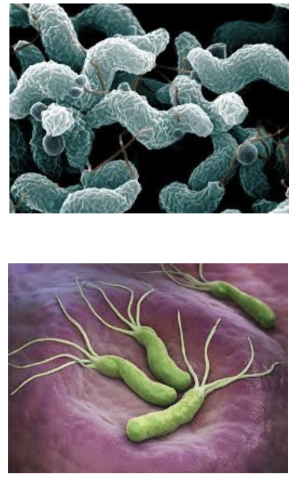 <ul><li><p><strong><em>Campylobacter jejuni</em></strong> <span style="color: red;"><strong>causes gastroenteritis</strong></span></p></li></ul><ul><li><p><strong><em>Helicobacter pylori</em></strong> <span style="color: red;"><strong>causes gastritis, duodenal ulcers, and gastric cancer,</strong></span> clincial manifestations are not always evident and infection can lead to chronic conditions. </p></li></ul><p></p>