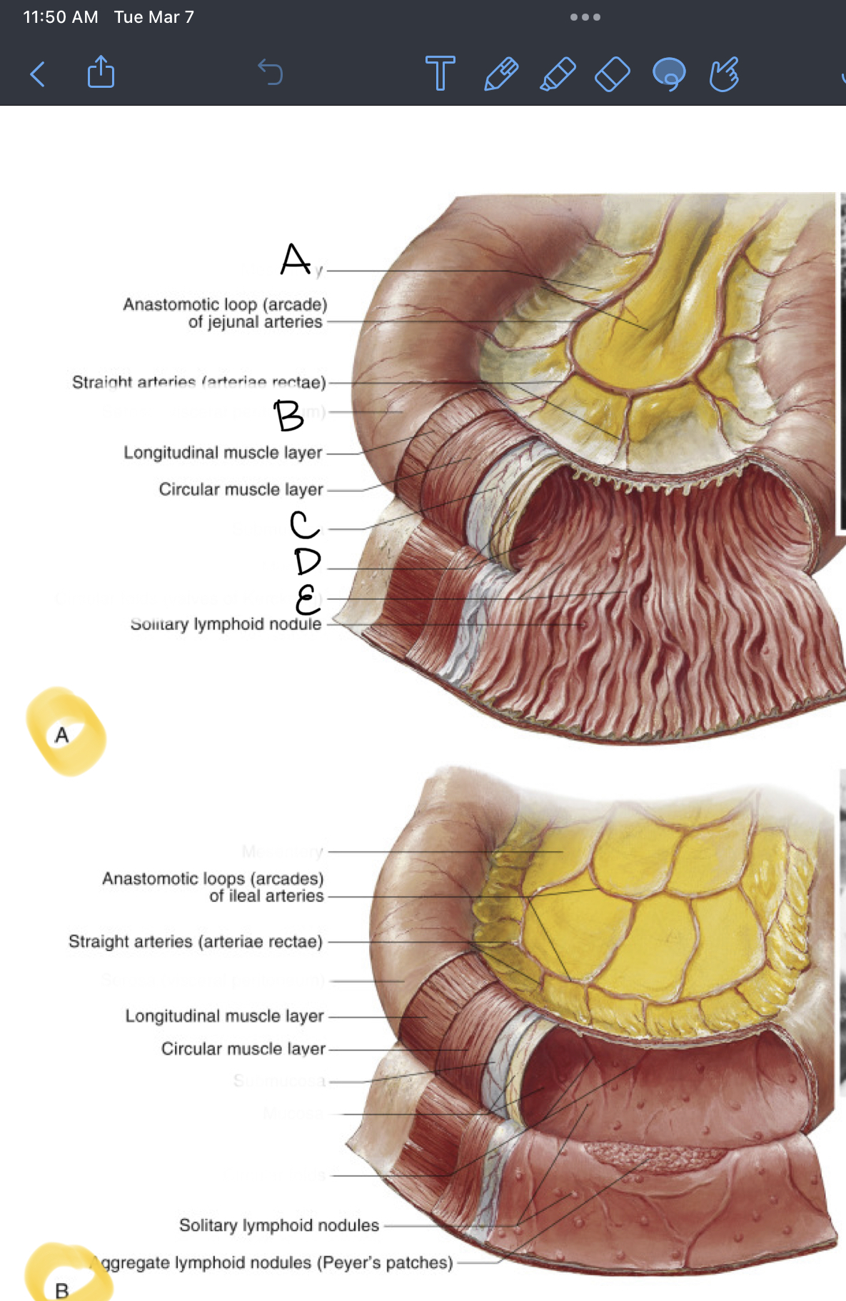 <p>What is the Top structure (picture A)</p>