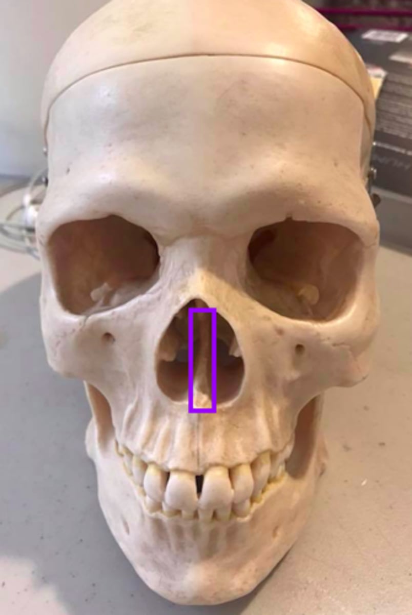 <p>What structures/features make up the nasal septum?</p>