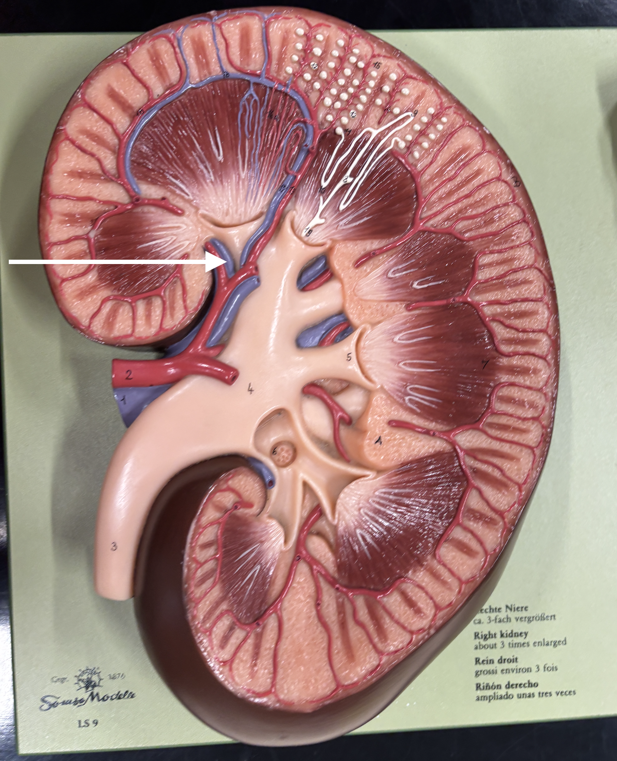 <p>what structure is the arrow pointing to? *vein*</p>