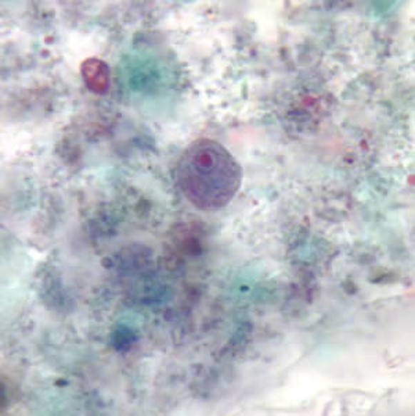 Endolimax nana