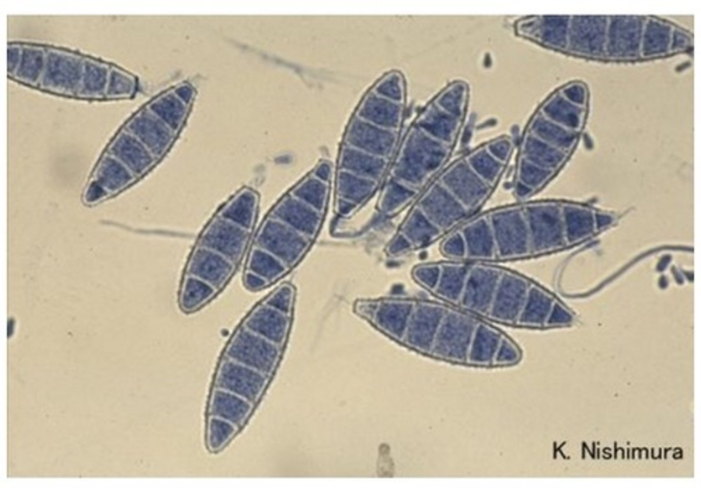 <p>• Scalp and skin infections,</p><p>common in animals</p><p>• Oval, rough walled</p><p>macroconidia with <6 cells</p>