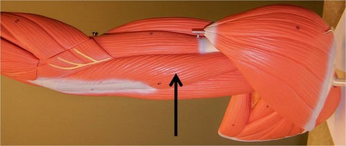 <p>Action: PRIME MOVER extends elbow and arm at shoulder Insertion: olecranon of ulna</p>