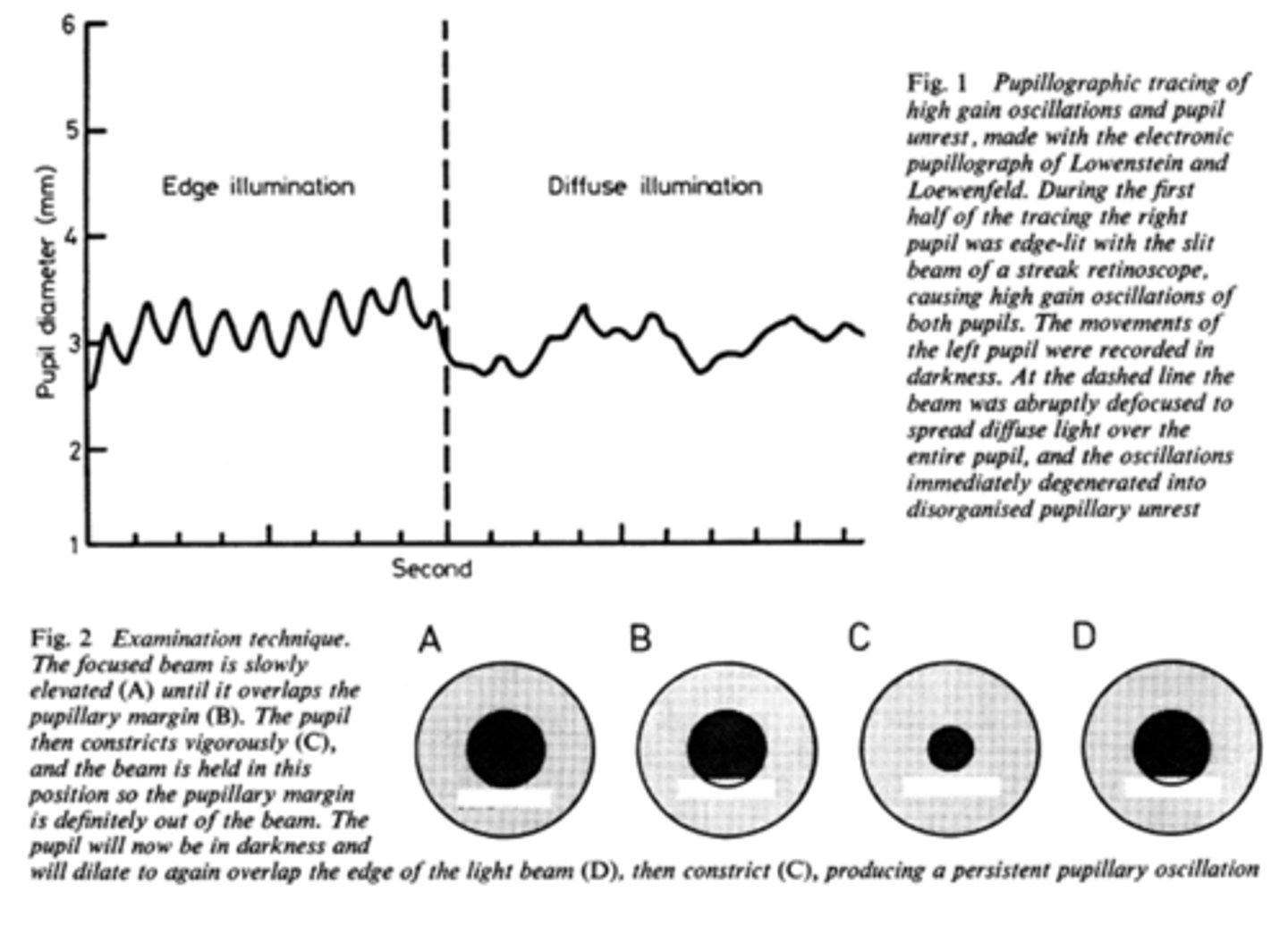 <p>tells us how much impulse is getting to the E-W nucleus = another indicator of ONH function</p>