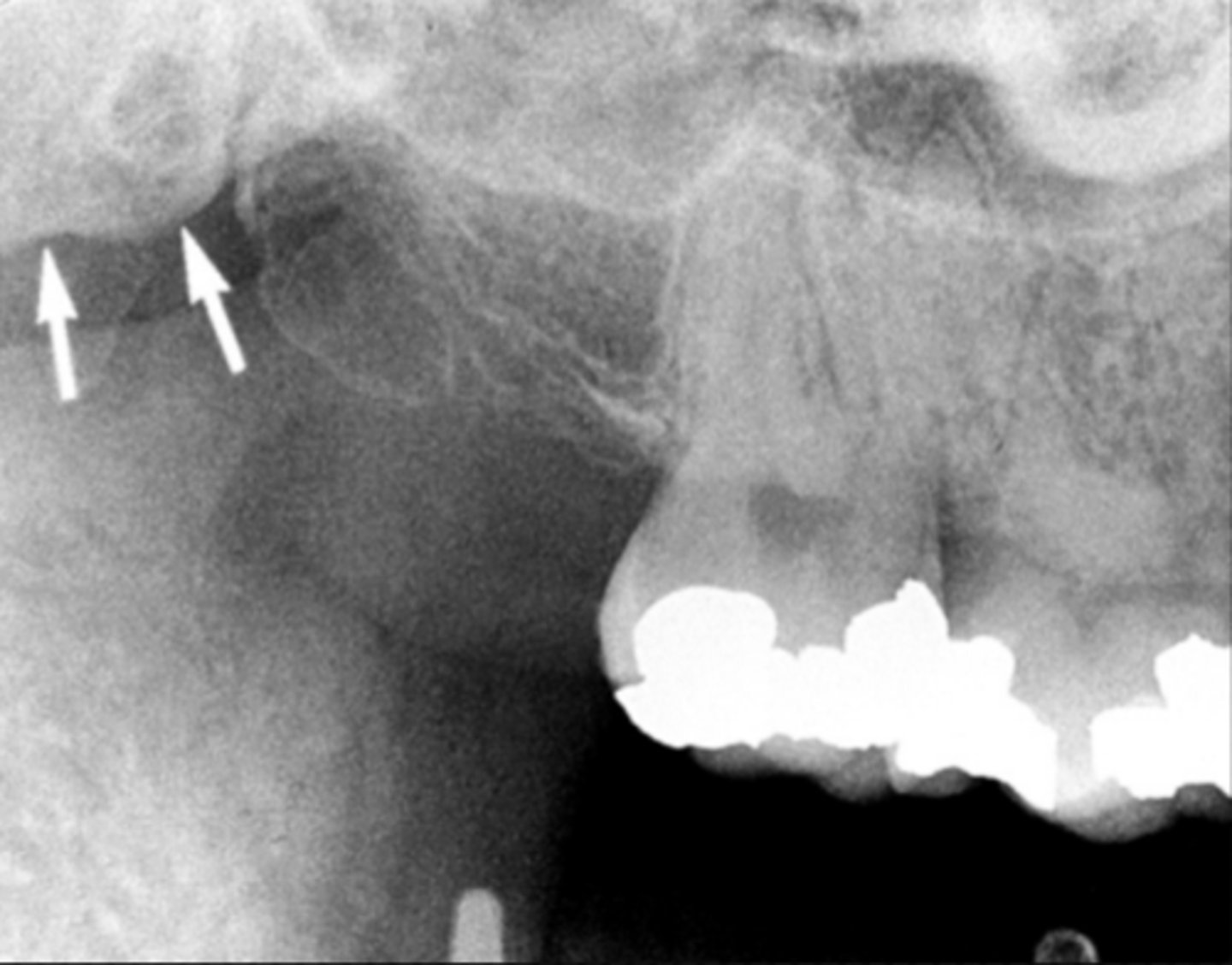 <p>Identify the structure</p>