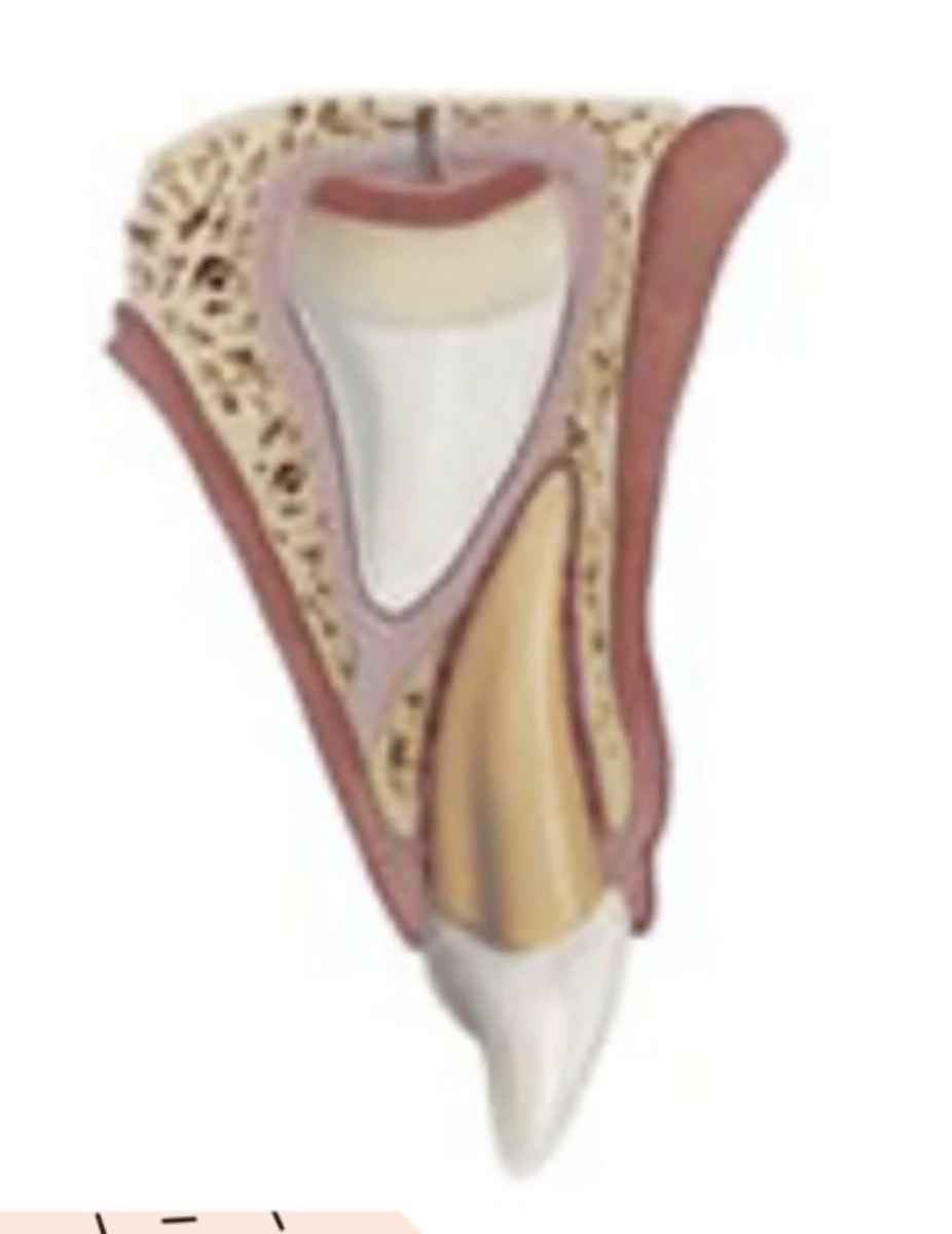 <p>a. Subluxation</p>