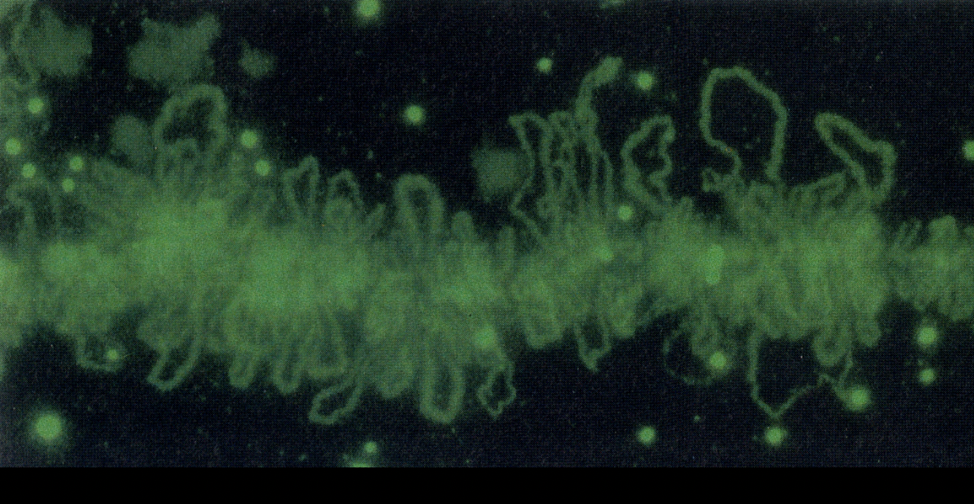 <ul><li><p>use a floresecent histone</p></li></ul><p></p>