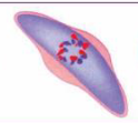 <ul><li><p>Banana shaped gametocyte</p></li><li><p>more than one organism in a RBC</p></li><li><p>more than one organism seen in a blood smear</p></li><li><p>Has HIGH infectivity and a HIGH parasite load </p></li></ul><p></p>