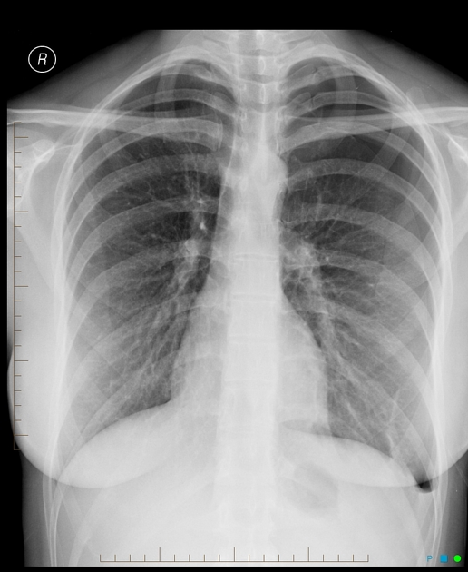 <p>Describe the abnormality demonstrated. </p>