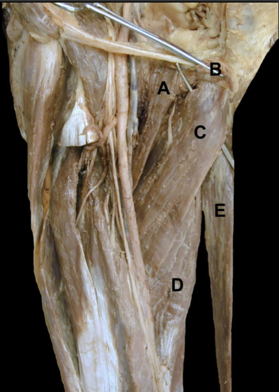 <p>What muscles share the same insertion as&nbsp;“E”?&nbsp;</p>