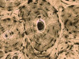 <p>Structural unit of compact bone consisting of concentric lamellae around a central canal.</p>