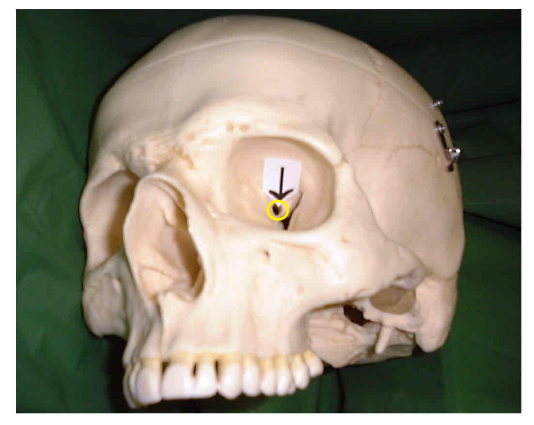 term image