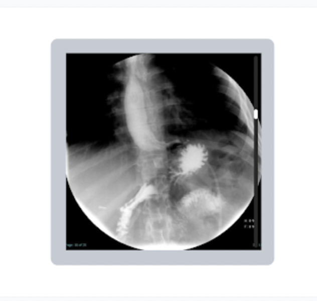 <p>Which fluoroscopic procedure is demonstrated in the following image? </p><p>a. urology study </p><p>b. gastroenterology study </p><p>c. cardiology study </p><p>d. orthopedic study </p>