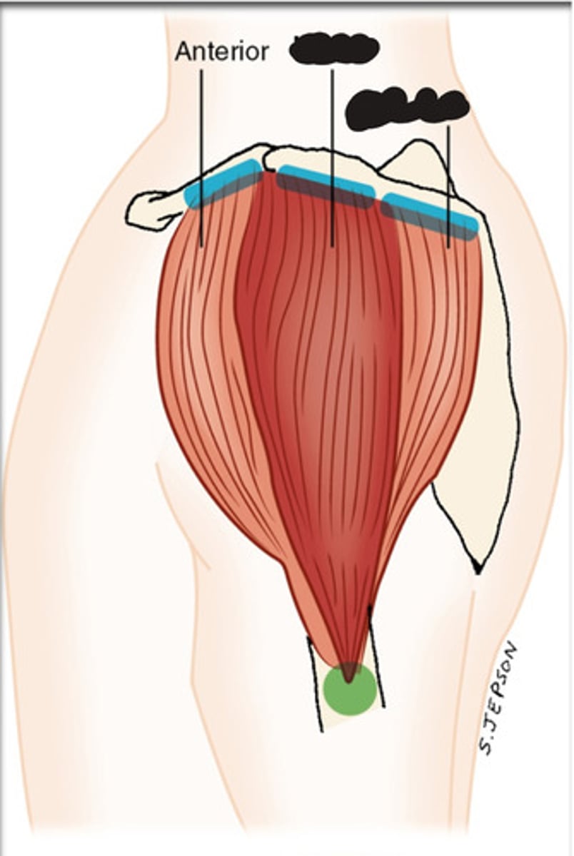 <p>What muscle is this?</p>